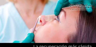 recuperacion rinoplastia rapida sevilla