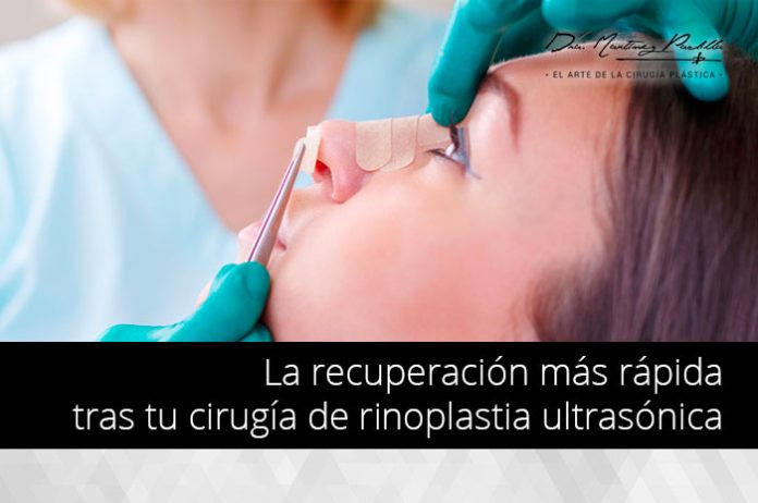 recuperacion-rinoplastia-nariz-sevilla recuperacion rinoplastia rapida sevilla